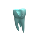 Molded plastic molar with an abscess representing dental abscesses and periodontitis