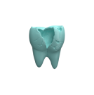 Molded plastic tooth with an abscess representing dental abscesses and tooth loss
